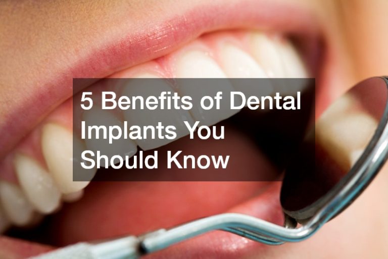 5 Benefits of Dental Implants You Should Know