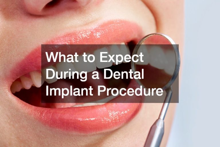 What to Expect During a Dental Implant Procedure